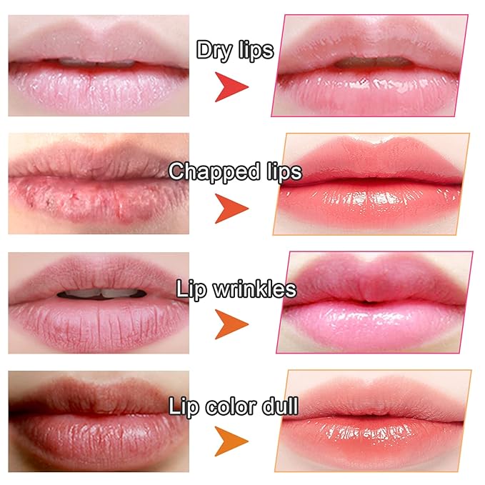 🔥The Last Day 60% OFF🔥 Moisturizing Collagen Lip Masks