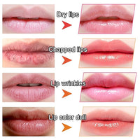 Thumbnail for Moisturizing Collagen Lip Masks